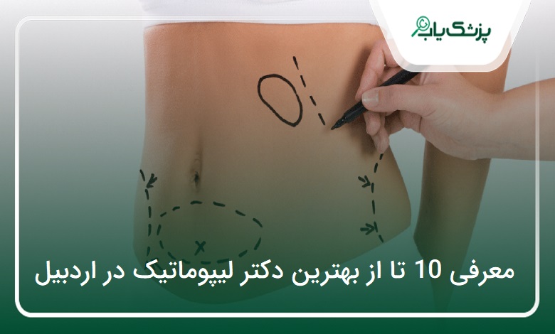 بهترین دکتر لیپوماتیک در اردبیل