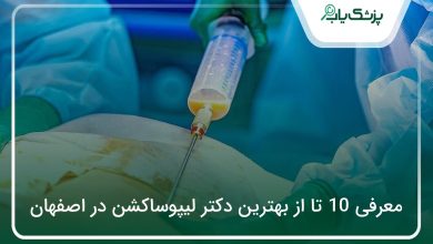 بهترین دکتر لیپوساکشن در اصفهان