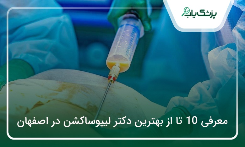 بهترین دکتر لیپوساکشن در اصفهان