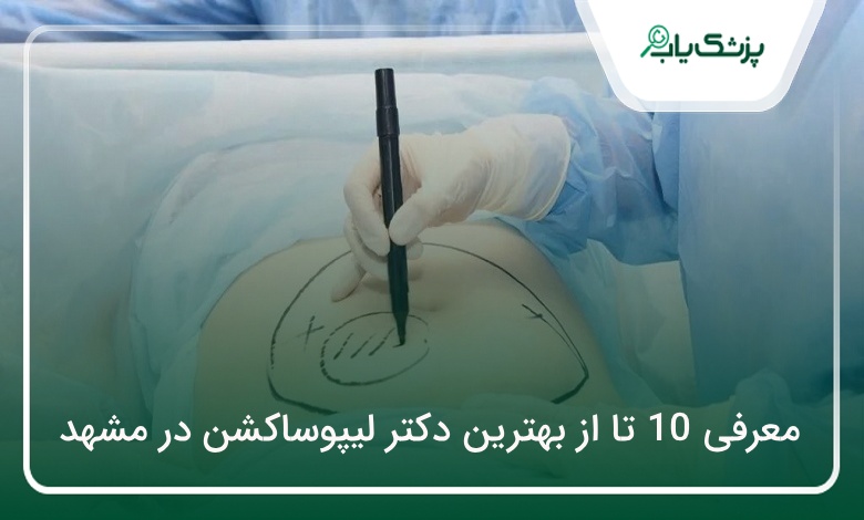 بهترین دکتر لیپوساکشن در مشهد
