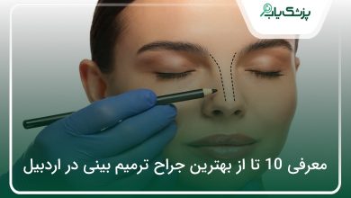 بهترین جراح ترمیم بینی در اردبیل