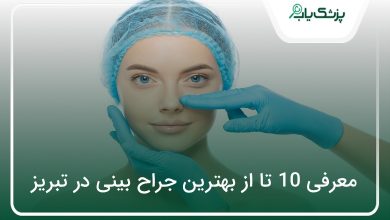 بهترین جراح بینی در تبریز