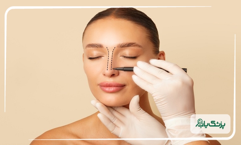 تکنیک های نوین جراحی بینی استخوانی در تبریز