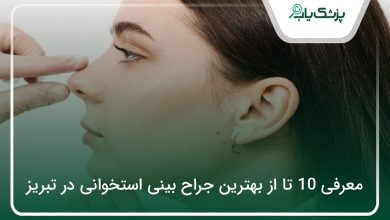 بهترین جراح بینی استخوانی در تبریز
