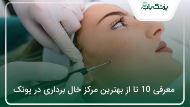 بهترین مرکز خال برداری در پونک