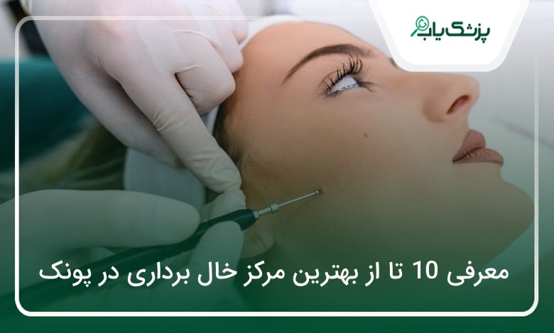 بهترین مرکز خال برداری در پونک