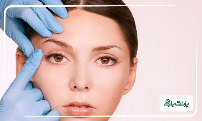 جراحی لیفت شقیقه در تبریز برای کشیدگی چشم و ابرو