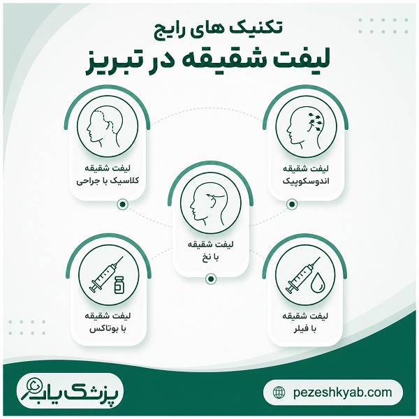 تکنیک های رایج لیفت شقیقه در تبریز
