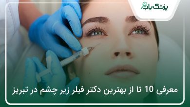 بهترین دکتر فیلر زیر چشم در تبریز