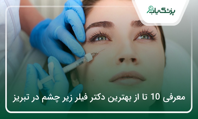 بهترین دکتر فیلر زیر چشم در تبریز