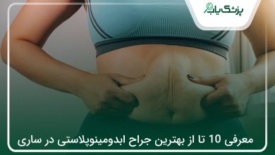 بهترین جراح ابدومینوپلاستی در ساری