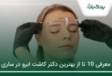بهترین دکتر کاشت ابرو در ساری