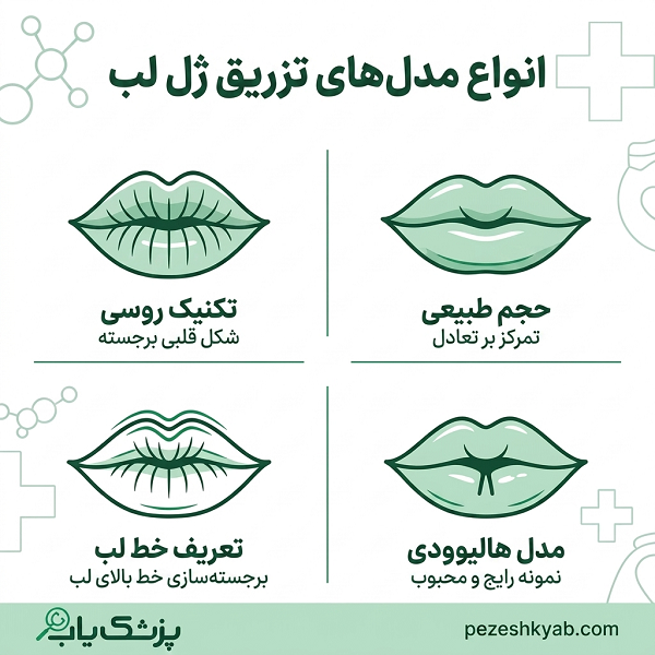انواع مدل های تزریق ژل لب
