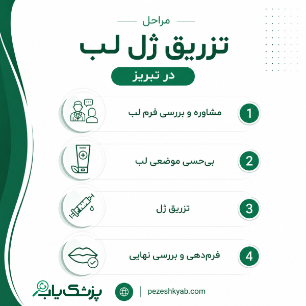 مراحل تزریق ژل لب در تبریز