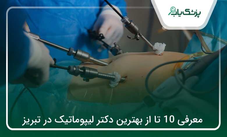 بهترین دکتر لیپوماتیک در تبریز