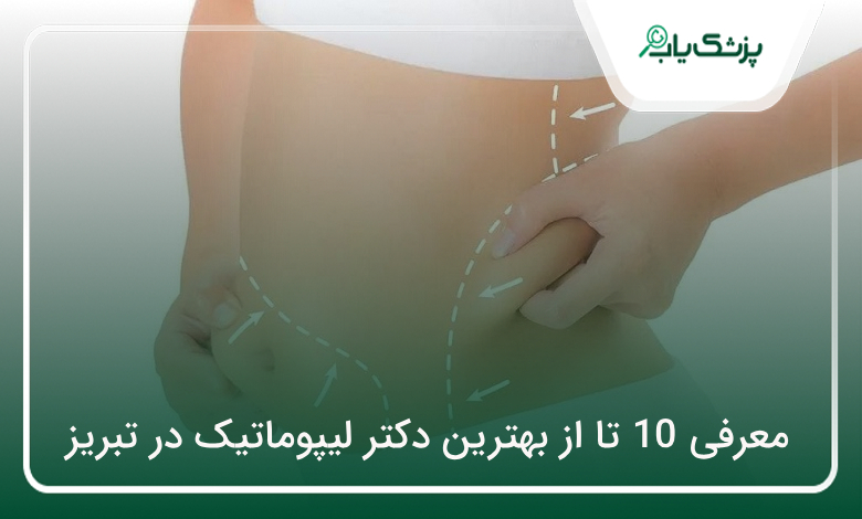 بهترین دکتر لیپوماتیک در تبریز