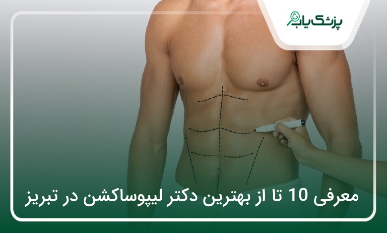 بهترین دکتر لیپوساکشن در تبریز