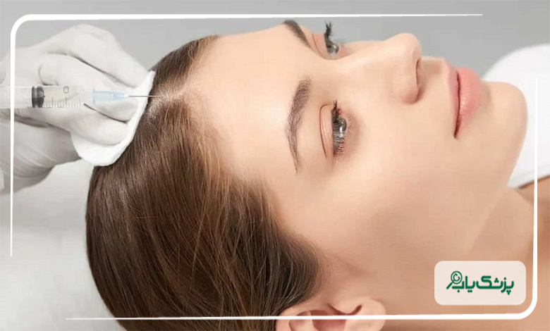 مزوتراپی برای چه کسانی مناسب نیست؟