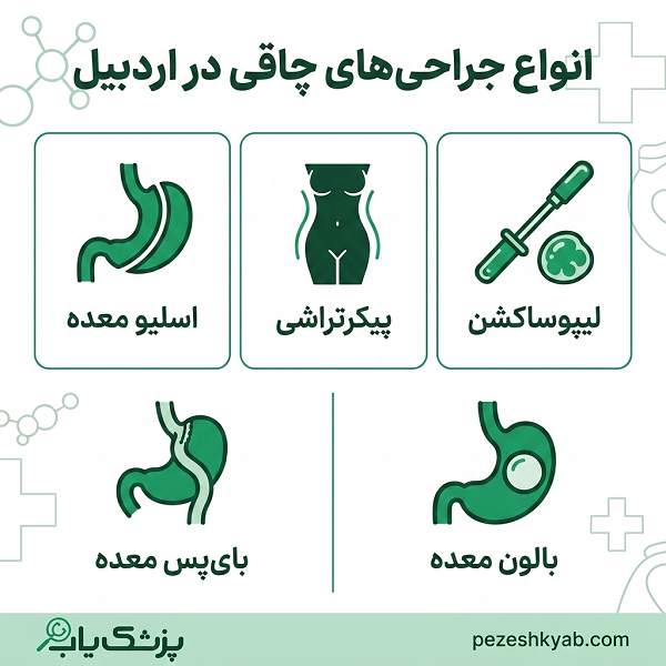 انواع جراحی های چاقی در اردبیل
