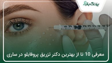 بهترین دکتر تزریق پروفایلو در ساری
