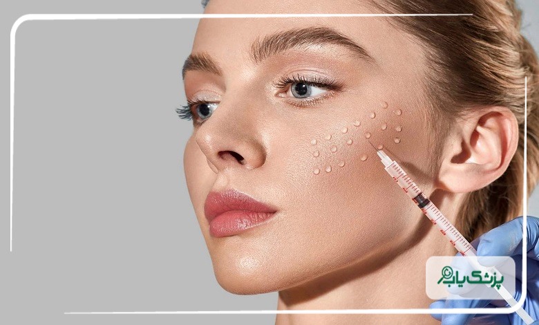 چه افرادی باید به بهترین دکتر تزریق پروفایلو در ساری مراجعه کنند؟