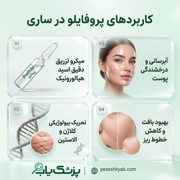 کاربردهای پروفایلو در ساری