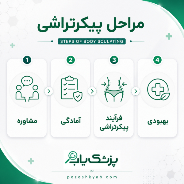 مراحل پیکرتراشی در ساری