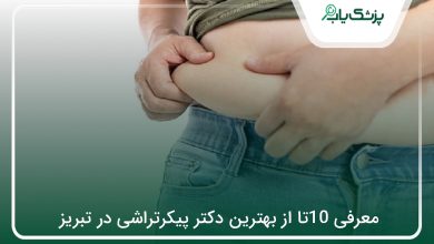 بهترین دکتر پیکرتراشی در تبریز