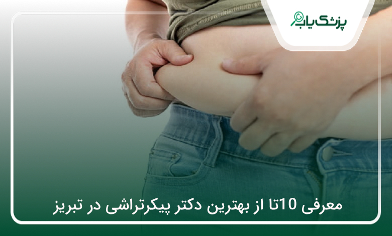 بهترین دکتر پیکرتراشی در تبریز