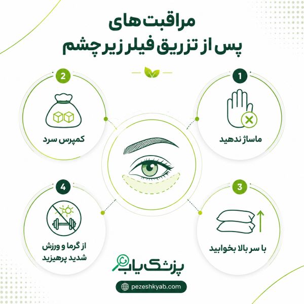 مراقبت های بعد از تزریق فیلر زیر چشم