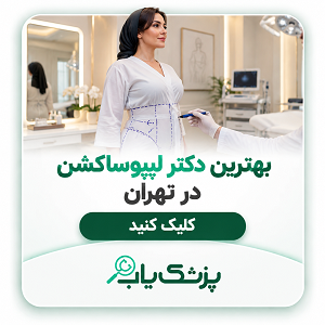 بهترین دکتر لیپوساکشن در تهران