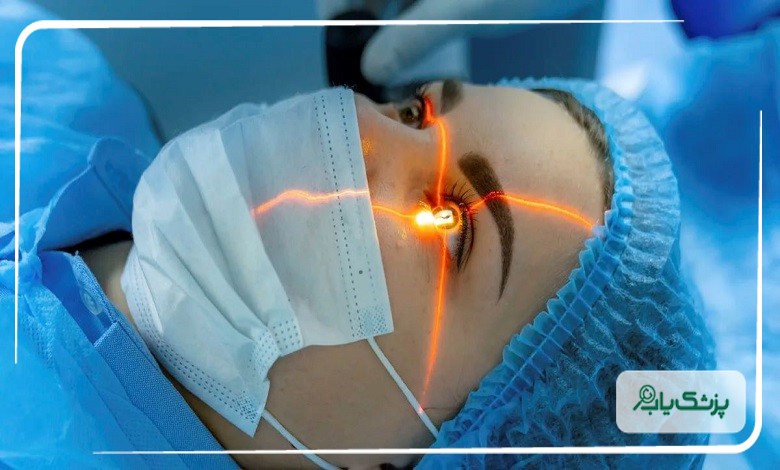 جراحی پیشرفته لیزیک چشم در کرج
