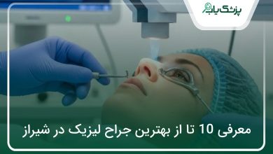 بهترین جراح لیزیک در شیراز