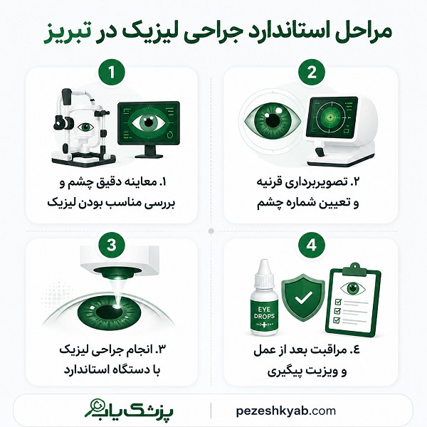 مراحل استاندارد جراحی لیزیک در تبریز