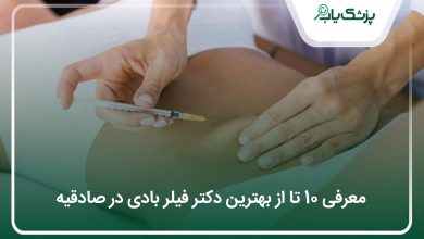 بهترین دکتر فیلربادی در صادقیه