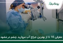 بهترین جراح آب مروارید چشم در مشهد