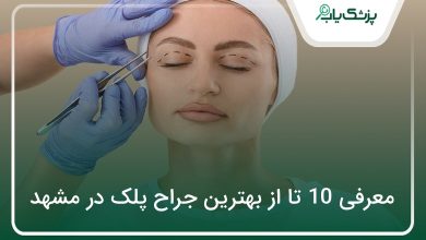 بهترین جراح پلک در مشهد
