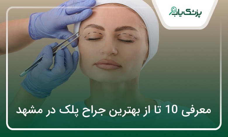 بهترین جراح پلک در مشهد