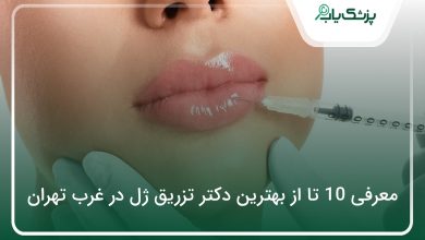 بهترین دکتر تزریق ژل در غرب تهران