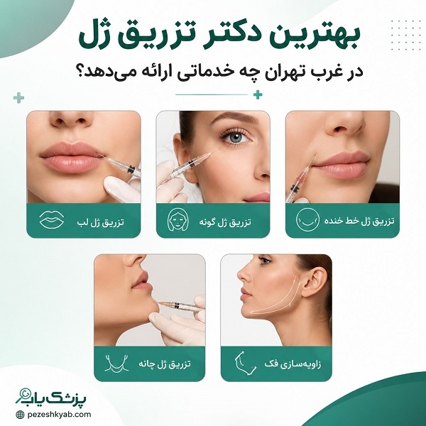 بهترین دکتر تزریق ژل در غرب تهران چه خدماتی ارائه میدهد؟