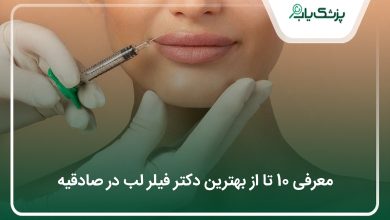 بهترین دکتر فیلرلب در صادقیه