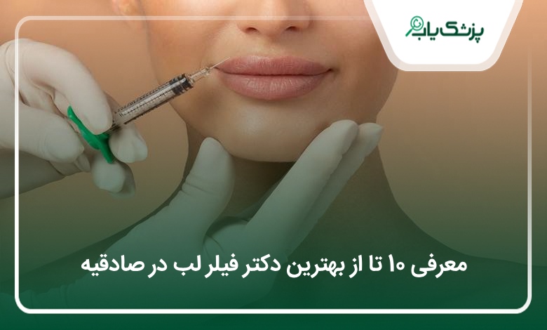 بهترین دکتر فیلرلب در صادقیه