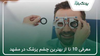 بهترین چشم پزشک در مشهد