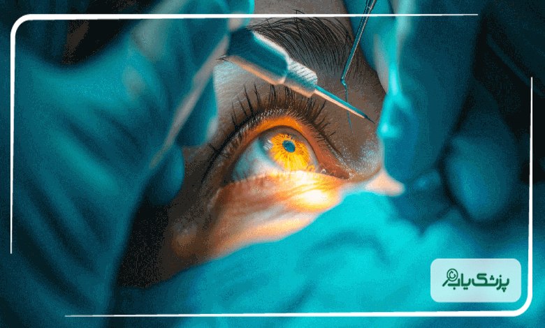 جراحی اسمایل توسط بهترین متخصصان در مشهد