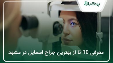 بهترین جراح اسمایل در مشهد