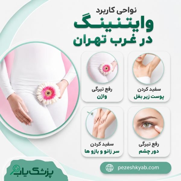 نواحی کاربرد وایتنینگ در غرب تهران