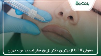 بهترین دکتر تزریق فیلر لب در غرب تهران