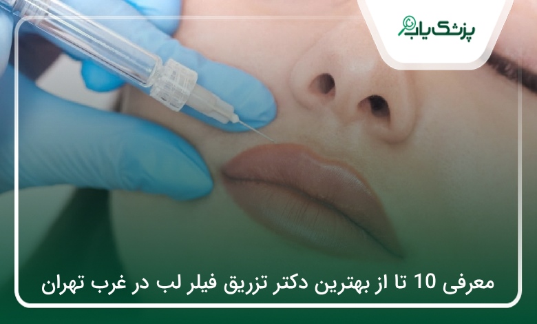 بهترین دکتر تزریق فیلر لب در غرب تهران