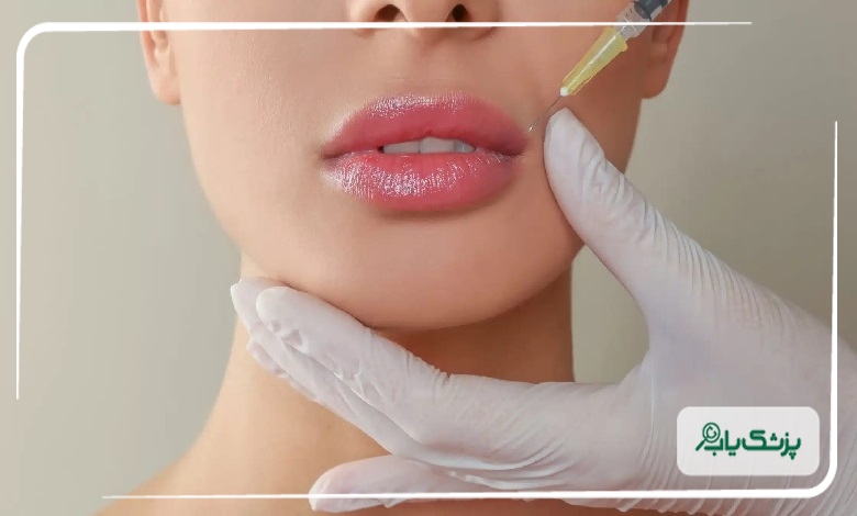 نتیجه نهایی بعد از تزریق فیلر لب چه زمانی مشخص میشود؟