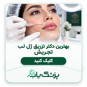 بهترین دکتر تزریق ژل لب تجریش